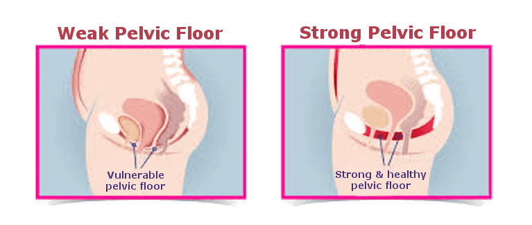 What happens on the first day of pelvic floor physical therapy?